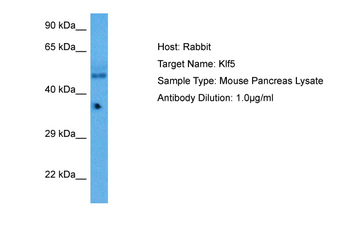 KLF2 Rabbit Polyclonal Antibody