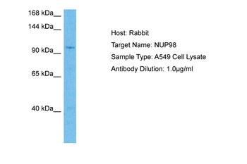NUP98 Rabbit Polyclonal Antibody