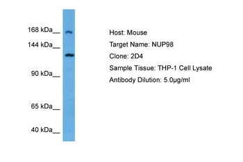NUP98 Rabbit Polyclonal Antibody