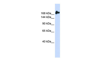 NUP98 Rabbit Polyclonal Antibody