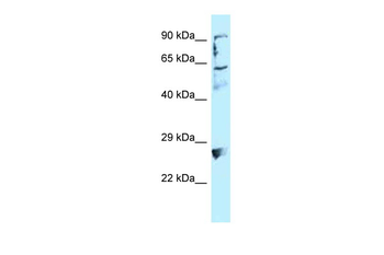 LIMA1 Rabbit Polyclonal Antibody