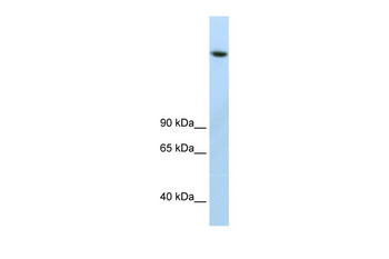 JMJD1B Rabbit Polyclonal Antibody