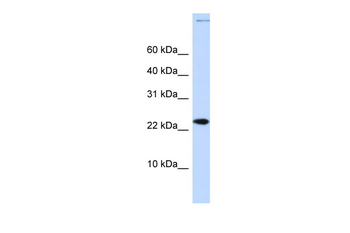 CHRAC1 Rabbit Polyclonal Antibody