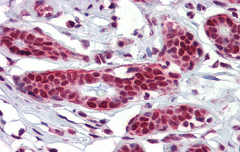 NKRF Rabbit Polyclonal Antibody