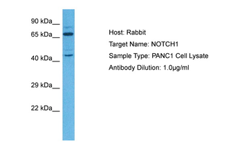 NOTCH1 Rabbit Polyclonal Antibody