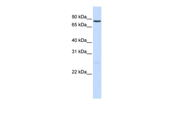 NOTCH1 Rabbit Polyclonal Antibody