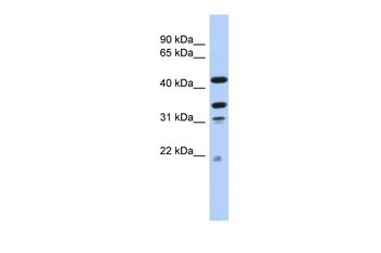 GATAD2A Rabbit Polyclonal Antibody