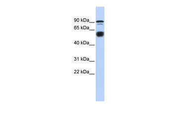 BCL11A Rabbit Polyclonal Antibody
