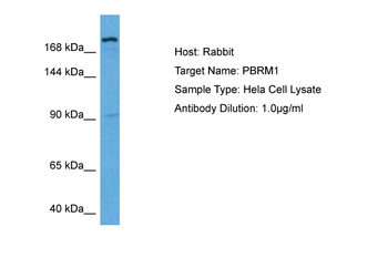 PBRM1 Rabbit Polyclonal Antibody