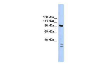 PBRM1 Rabbit Polyclonal Antibody