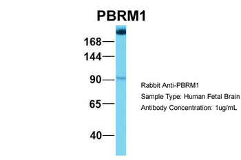PBRM1 Rabbit Polyclonal Antibody