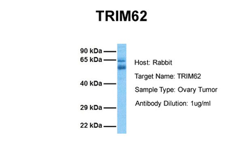 TRIM62 Rabbit Polyclonal Antibody