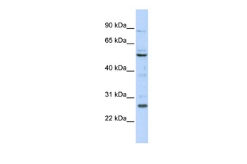 HOXC5 Rabbit Polyclonal Antibody