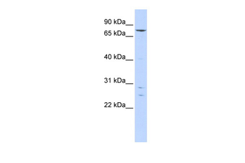 KLHL4 Rabbit Polyclonal Antibody