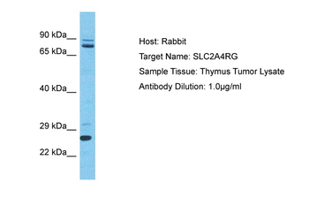 SLC2A4RG Rabbit Polyclonal Antibody