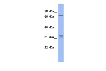 PRDM8 Rabbit Polyclonal Antibody