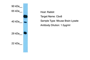 CBX4 Rabbit Polyclonal Antibody