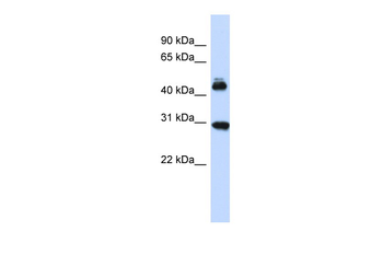 CBX4 Rabbit Polyclonal Antibody