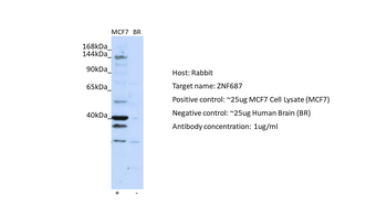 ZNF687 Rabbit Polyclonal Antibody