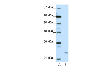 ZNF253 Rabbit Polyclonal Antibody