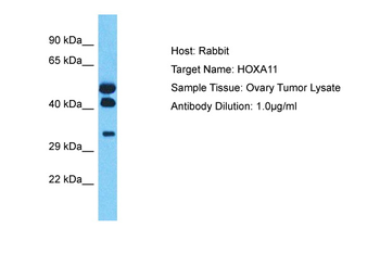 HOXA11 Rabbit Polyclonal Antibody