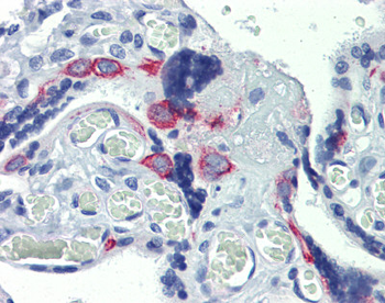 ZNF71 Rabbit Polyclonal Antibody