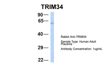 TRIM34 Rabbit Polyclonal Antibody