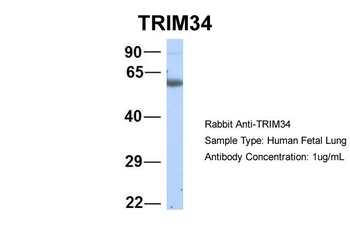 TRIM34 Rabbit Polyclonal Antibody