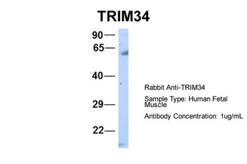 TRIM34 Rabbit Polyclonal Antibody