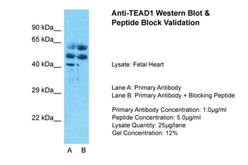 TEAD1 Rabbit Polyclonal Antibody