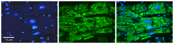 OPTN Rabbit Polyclonal Antibody
