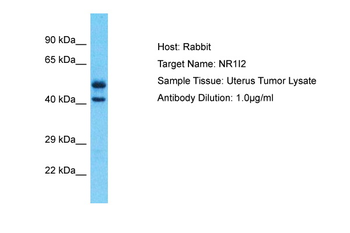 NR1I2 Rabbit Polyclonal Antibody