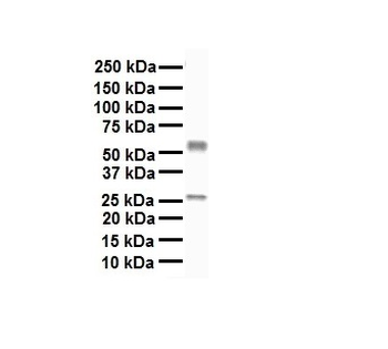 NR1I2 Rabbit Polyclonal Antibody