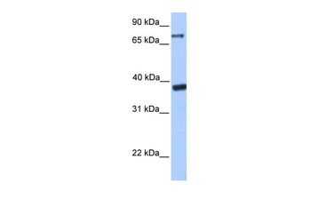 DIDO1 Rabbit Polyclonal Antibody