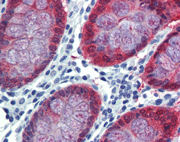HOXC8 Rabbit Polyclonal Antibody