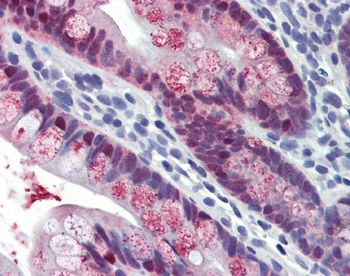 HOXC8 Rabbit Polyclonal Antibody