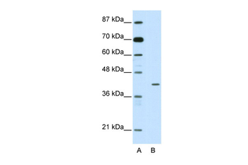 HMBOX1 Rabbit Polyclonal Antibody