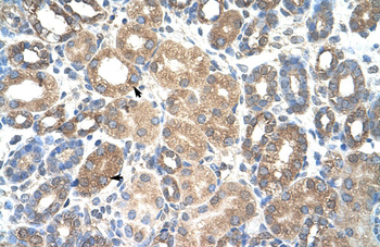 HSPBAP1 Rabbit Polyclonal Antibody
