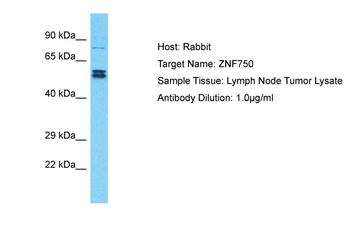 ZNF750 Rabbit Polyclonal Antibody