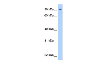 ZNF408 Rabbit Polyclonal Antibody