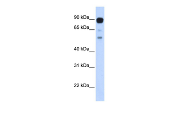 ZNF408 Rabbit Polyclonal Antibody