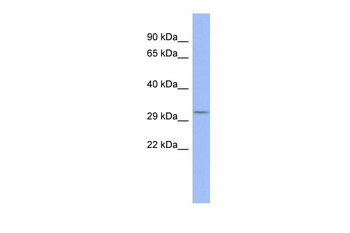 OTP Rabbit Polyclonal Antibody
