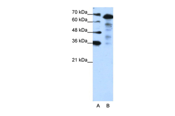 MLXIPL Rabbit Polyclonal Antibody