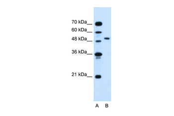 NR1I2 Rabbit Polyclonal Antibody
