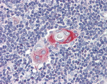 CPXCR1 Rabbit Polyclonal Antibody