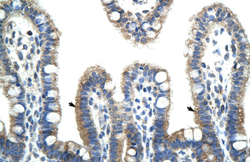 BTBD6 Rabbit Polyclonal Antibody