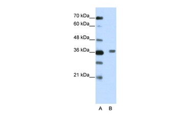 BTBD6 Rabbit Polyclonal Antibody