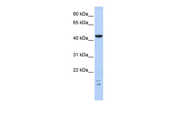 BTBD6 Rabbit Polyclonal Antibody