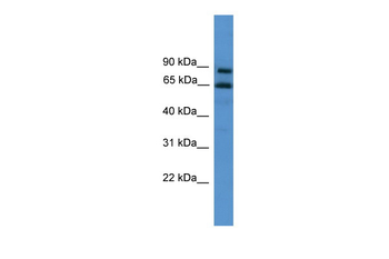 ZNF257 Rabbit Polyclonal Antibody