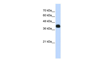 ISL2 Rabbit Polyclonal Antibody